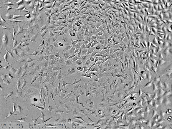 Mice cells. L929 клетки. Клеточная линия l 929. Д-929 Cell line. Микоплазменное поражение культуры клеток l929.